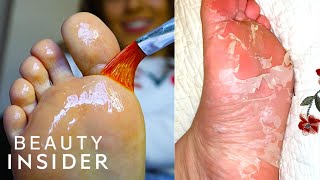 How A Chemical Peel Exfoliates Your Feet  Beauty Explorers [upl. by Llecrad]