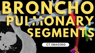 Segmental anatomy of the lung  Radiology anatomy part 1 prep  Bronchopulmonary segments on CT [upl. by Photina]