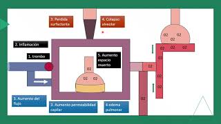 tromboembolismo pulmonar FISIOPATOLOGÍA parte 2 [upl. by Franny]