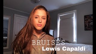 ally salort  bruises lewis capaldi cover [upl. by Ahsinal]