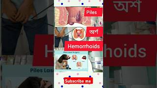 Piles or Hemorrhoids [upl. by Dixon]