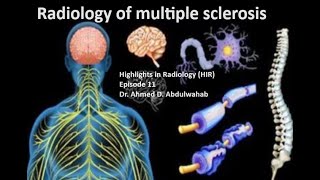 Multiple sclerosis radiology Highlights In Radiology HIR episode 11 [upl. by Lewert]