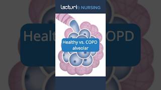 Healthy vs COPD Lungs 🫁 LungHealth COPDAwareness nclexrn [upl. by Neiht]