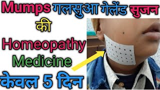 Mumps  गलसुआ  homeopathc medicin for mumps diseases [upl. by Maiga]