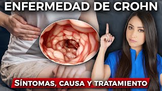 ¿Qué es la ENFERMEDAD DE CROHN👩🏻‍⚕️ l Causa SÍNTOMAS y tratamiento drapauzuniga [upl. by Laaspere]