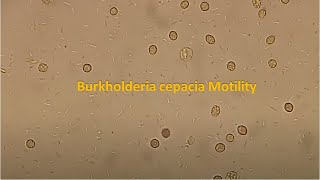 Burkholderia cepacia Motility [upl. by Htedirem40]