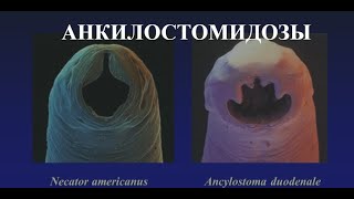 Анкилостомидозы Анкилостомоз Ancylostoma duodenale и Некатороз Necator americanus [upl. by Amada938]