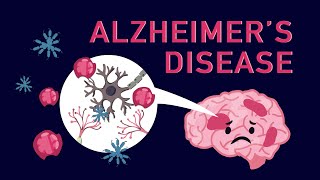 What is Alzheimer’s Disease [upl. by Spanjian]