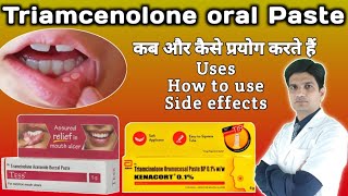 Kenacort 01  Kenacort gel how to use  Triamcinolone oromucosal paste bp 01 ww [upl. by Chor]