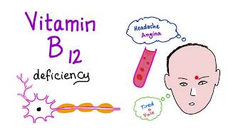 Vitamin B12 Cobalamin Deficiency  Causes Symptoms Diagnosis amp Management  Hematology Series [upl. by Tongue212]