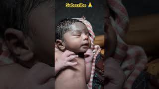 First Few Seconds ago Birth of NEWBORN BABY cute firstlook Newborn baby viral [upl. by Anafetse]