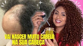 O CABELO CRESCE MUITO E NÃO CAI MELHOR RECEITA DO MUNDO PARA CRESCER CABELO projetorapunzel 🔥 [upl. by Copland526]