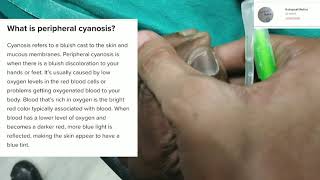 Peripheral Cyanosis  Practical viva  Clinical [upl. by Khalsa]