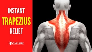 How to Fix Upper Trapezius Pain FOR GOOD [upl. by Aihtnis]