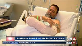 Fisherman survives flesheating bacteria [upl. by Meador]