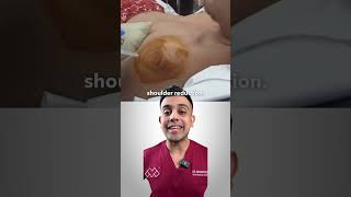 How Can You Fix A Dislocated Shoulder [upl. by Ruhnke506]