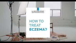 How to Treat Eczema  DERMCLASS [upl. by Graves204]