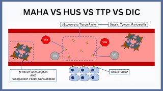 MAHA vs HUS vs TTP vs DIC [upl. by Fortunio10]