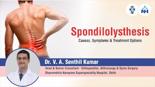 Spondylolisthesis  Causes Symptoms and Treatment Options  Dr V A Senthil Kumar [upl. by Ayital]