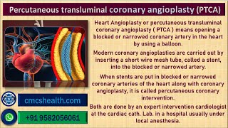 Coronary angioplasty PTCA cost in India with best interventional cardiologists  CMCS Health [upl. by Trinatte]