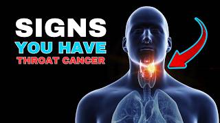 Warning Signs and Symptoms of Throat Cancer  Most Common Signs of Throat Cancer [upl. by Ybloc]