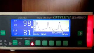 Novametrix 520A [upl. by Fredella16]