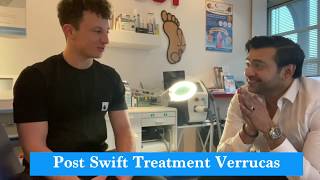 Verruca Swift Microwave Treatment Successful  Abid Hussain Podiatrist [upl. by Enetsirk]