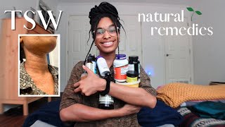 how I healed my Topical Steroid Withdrawal NATURALLY  en Español w subtitles  STORYTIME [upl. by Cal108]