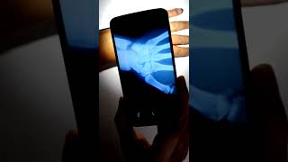 xray vision camera app  xray apps download [upl. by Edelstein285]