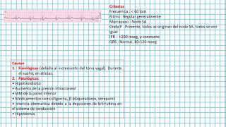 Bradicardia SINUSAL  Clases EKG 38 [upl. by Yasdnil]