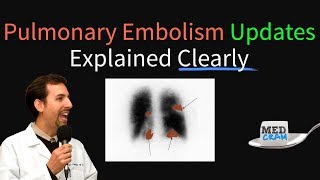 Pulmonary Embolism  Thromboembolism Updates Explained Clearly [upl. by Ivey]