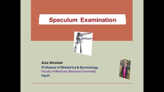 Speculum Examination [upl. by Atineb]