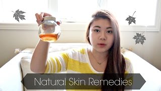 Natural Skin Remedies Allergies Dry Itchy Skin [upl. by Leitnahs]