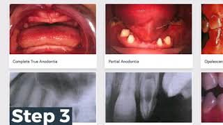 Pass Dental Prometric Exams Fast in 4 steps DHA NHRA MOH HAAD QCHP SDLE OMSB  eDental Portal [upl. by Netsreik]