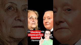 SHOCKING CHEMICAL PEEL BEFORE AND AFTER  Phenol Peel shorts [upl. by Daryn]