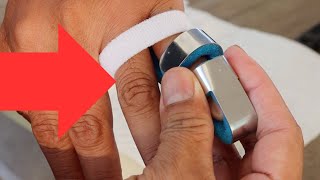 How To Apply a Mallet Finger Splint EASY WAY [upl. by Asille502]