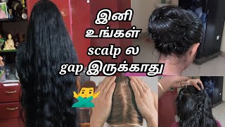 👉Scalp க்கும் Hair க்கும் இது மட்டுமே போதும் முடி அடர்த்தியா வளரSanaTamil [upl. by Nylyak]