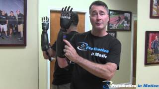 Below The Elbow Amputee Demonstrates BeBionic 3 Myoelectric Prosthesis [upl. by Eneleh]