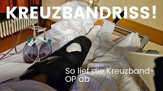 KREUZBANDRISS So lief die KreuzbandOP ab Schmerzen Narkose kreuzband op vlog kreuzbandriss [upl. by Vitek]