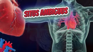 Situs ambiguus  Human Heart ❤️ and Cardiology ❤️🔊✅ [upl. by Nola]