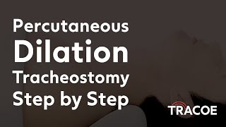 Percutaneous Dilation Tracheostomy Procedure Explained Step by Step [upl. by Tobi210]