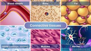 Understanding Soft Tissue Sarcoma [upl. by Maryly]