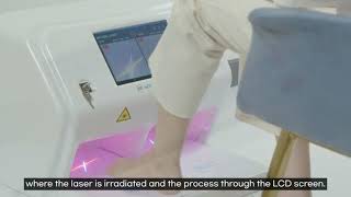 Mycosis Laser 소개영상 English Ver [upl. by Aicirpac]