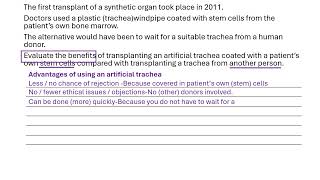 Stem cells 3 6 mark question [upl. by Palua]