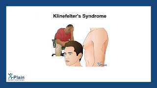 Klinefelters Syndrome [upl. by Aenotna425]