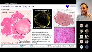 Cox T 2022 Tumour microenvironment [upl. by Elaval]