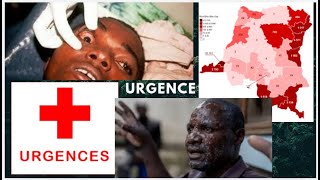 Situation Sanitaire Urgente en RDC Deux Virus Mortels  Abonnezvous et Partager [upl. by Hertz671]