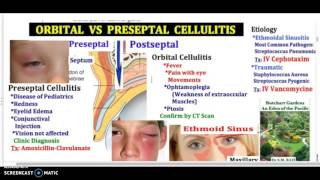 ORBITAL VS PRESEPTAL CELLULITIS USMLE I MCAT I Pediatric in 3 minutes [upl. by Casady]