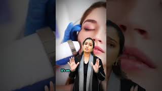 What is Fractional CO2 Laser Your Skins Secret Weapon skincare shortsviral laser beauty [upl. by Erminia735]