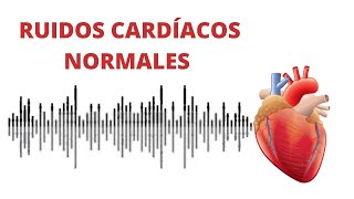 AUSCULTACIÓN CARDÍACA ruidos normales del corazón r1r2  s1s2 [upl. by Nauqel183]